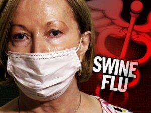 Swine Flu