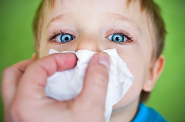 Increased cases of allergies in tico children