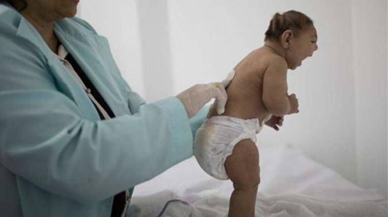 Experts Refute Pesticide-Caused Microcephaly, Still Researching Zika