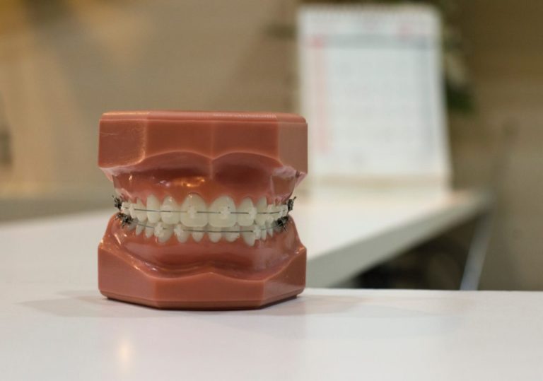 costa rica dental implants