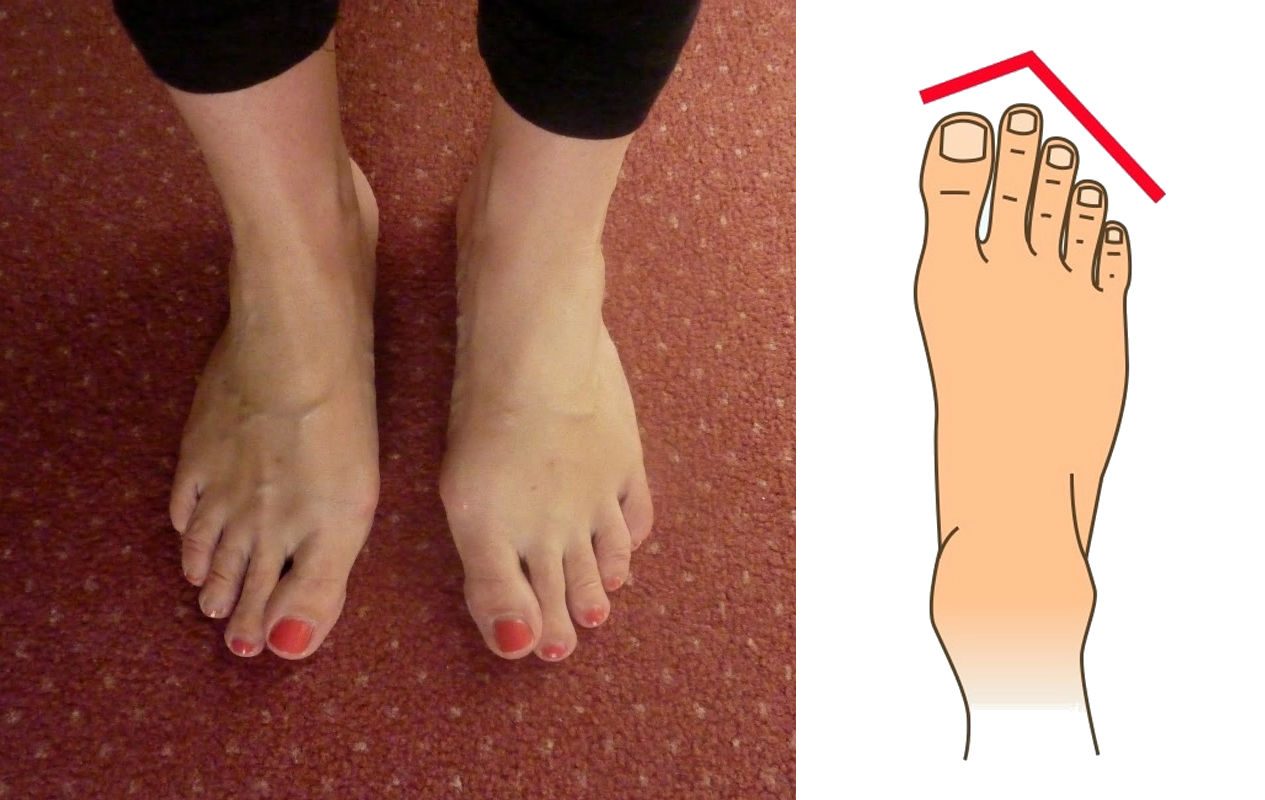 Discover Your Own Personality According To Your Feet s Shape