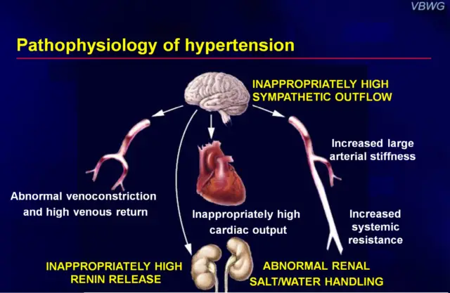 Pathophysiology of hypertension