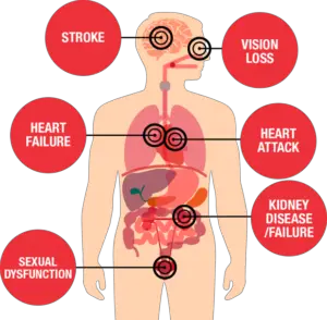 Symptoms of Hypertension