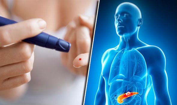 Diabetic pancreas