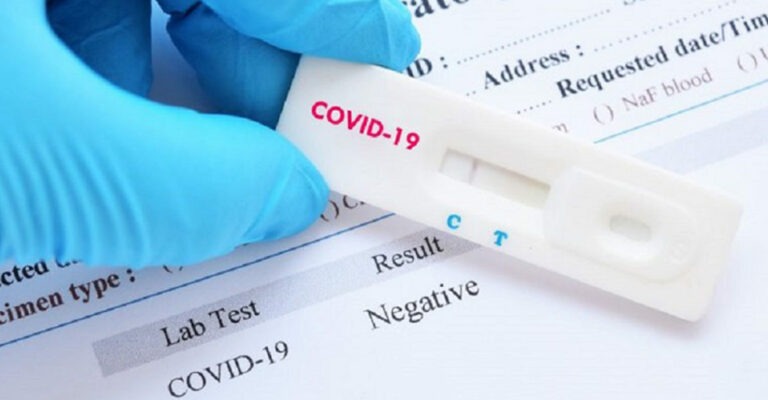 People Who Wish to Travel to the United States Must Present a Negative COVID-19 Test