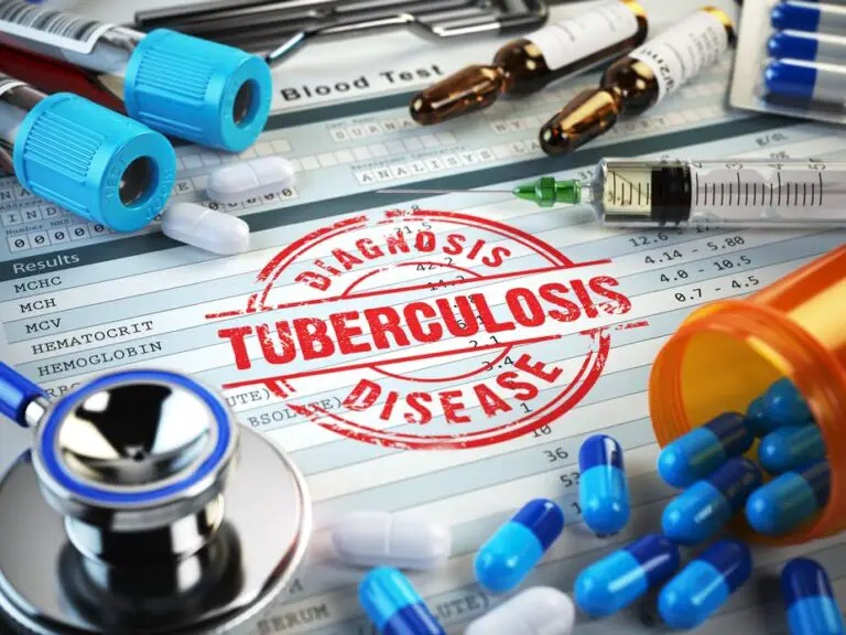 Costa Rica Among the Countries with the Least Cases of Tuberculosis