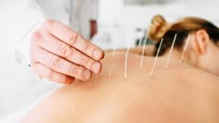 Acupuncture: How Does it Work And Why is it Good For Health?