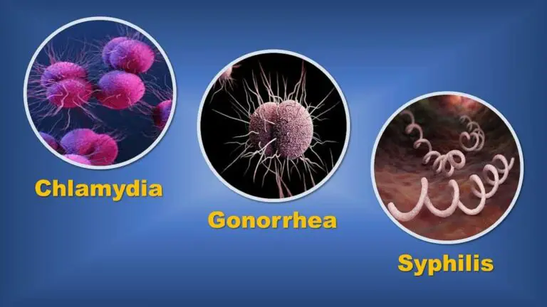 Gonorrhea, Syphilis, Chlamydia: What Do You Know About These Sexual Diseases?