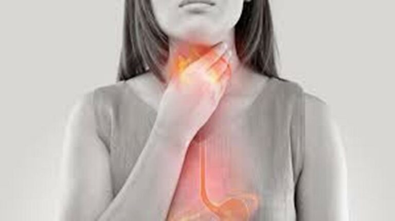 Gastroesophageal Reflux is One of the Conditions that Could Most Affect the Quality of Your Life
