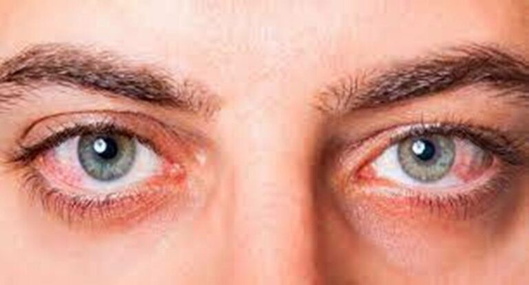 What Your Eyes Can Reveal About Your Health