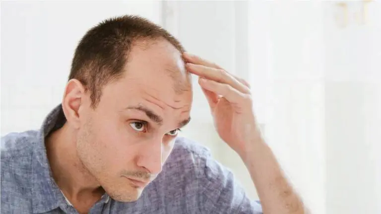 Baldness: These Drinks Can Increase the Risk of Alopecia