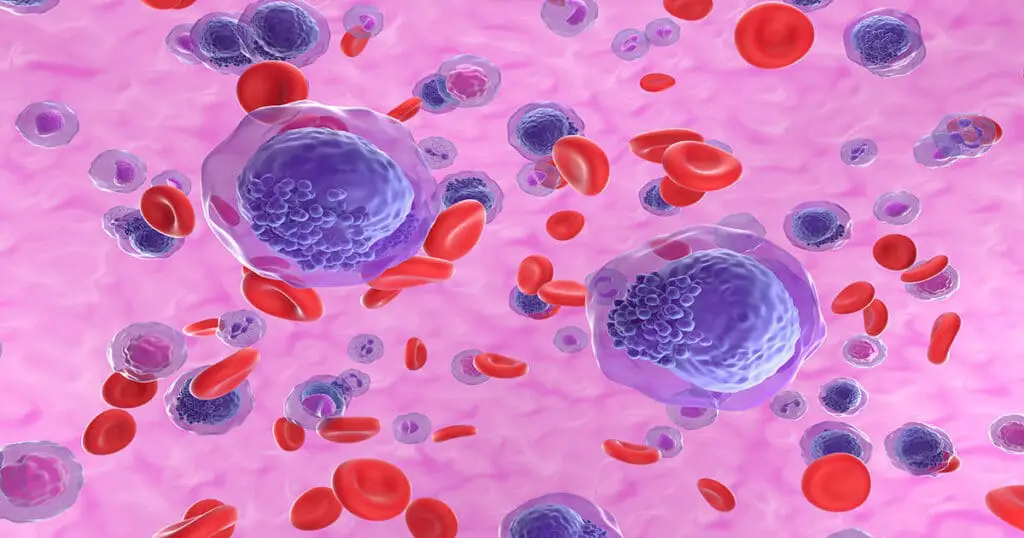 Experimental Pill Succeeds in Ending Acute Myeloid Leukemia