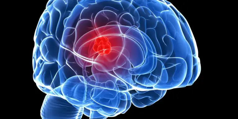 Scientists Achieve a New Technique to Treat the Deadliest Brain Tumor with Chemotherapy