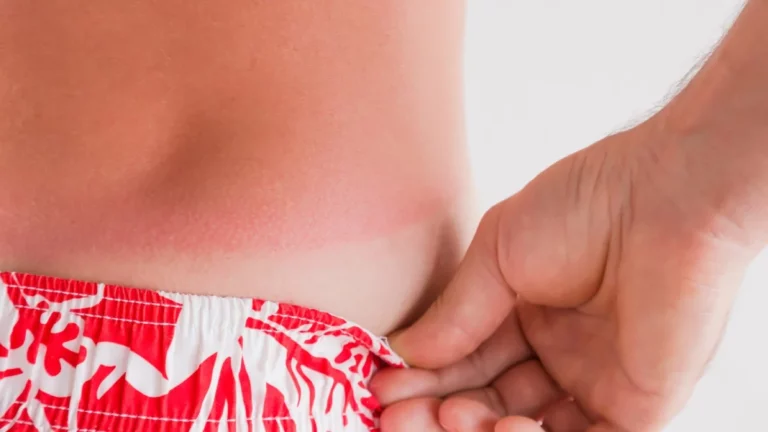 Sunbathing: How Much Time is Too Much and How Much is Too Little, According To Science