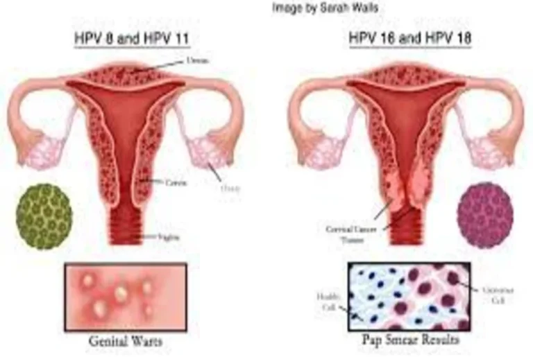 Human Papillomavirus Cases Have Increased by 44% in Costa Rica this Year